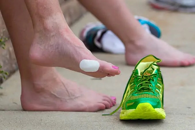 A runner's bare feet on a white towel, one toe taped over a blister and a darkened toenail.